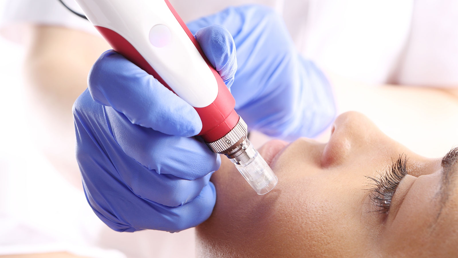 Аква чистка лица «HydraFacial»